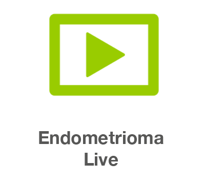 Endometrioma Video